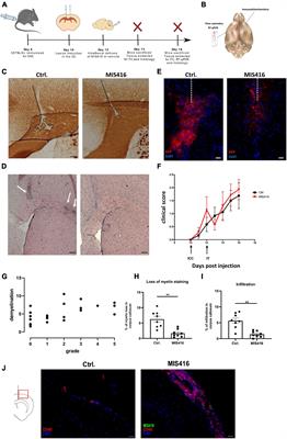 Innate Signaling in the CNS Prevents Demyelination in a Focal EAE Model